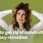 How to get rid of dandruff- 6 easy remedies